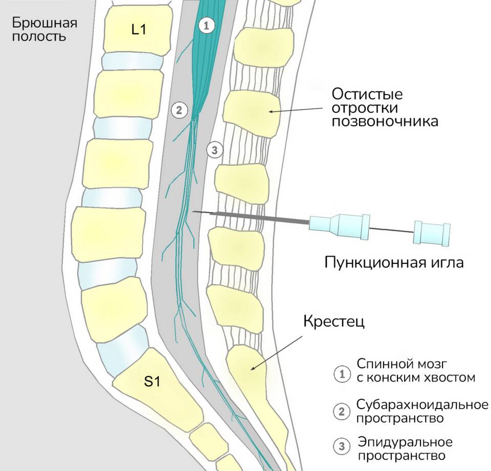 Что такое ARN транзакции